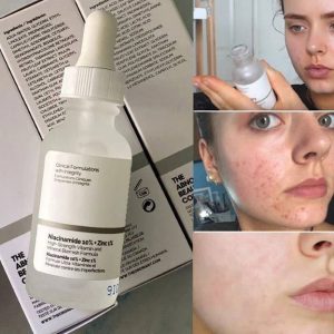 Effect-of-Niacinamide-ordinary